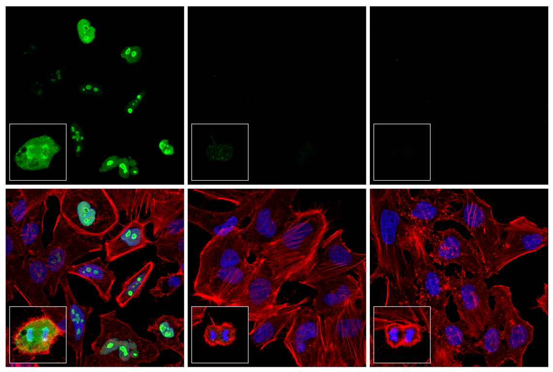 Immunofluorescence Image 1: Phospho-NPM1 (Thr199) (E4C7S) Rabbit Monoclonal Antibody