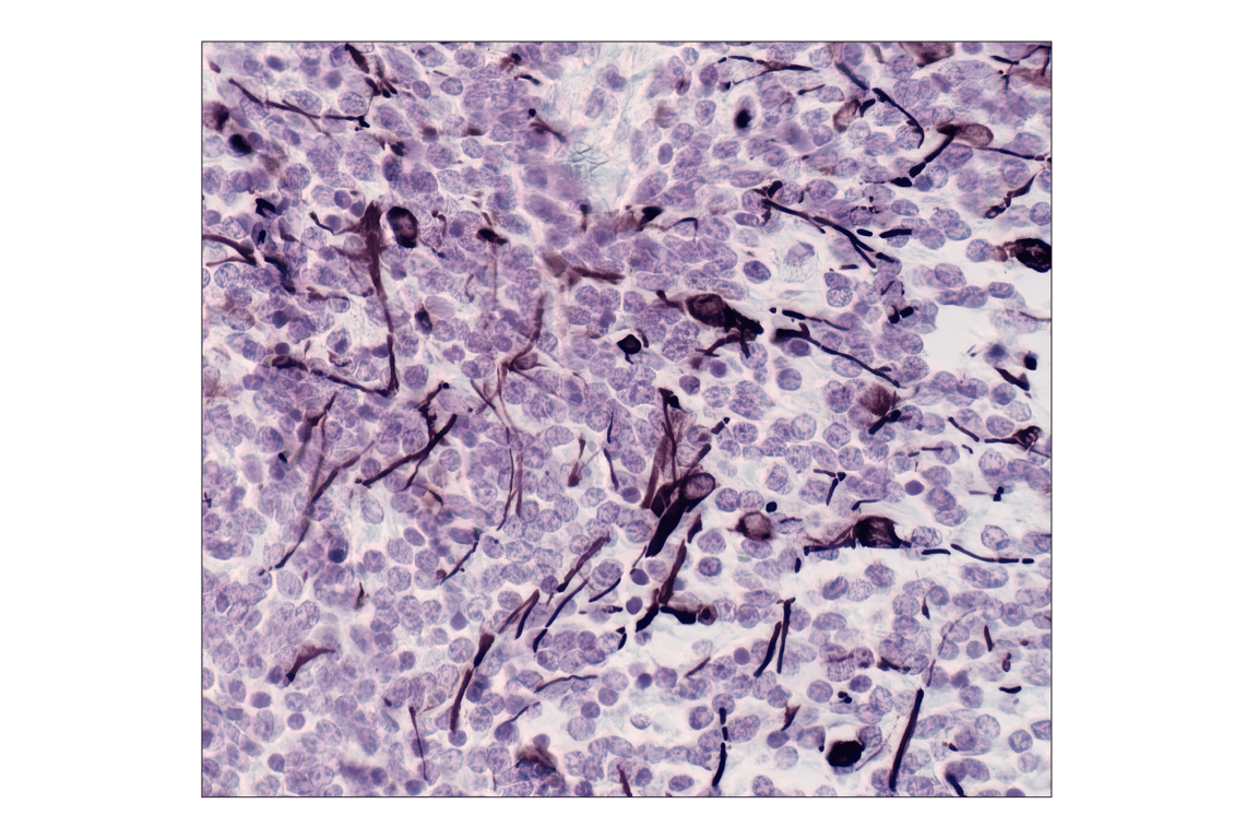 Immunohistochemistry Image 1: GFAP (GA5) Mouse Monoclonal Antibody