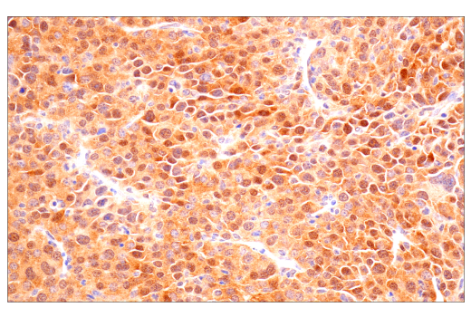 Immunohistochemistry Image 10: VHL (E3X9K) Rabbit Monoclonal Antibody (BSA and Azide Free)