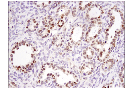 Immunohistochemistry Image 6: DNMT3A (D23G1) Rabbit Monoclonal Antibody