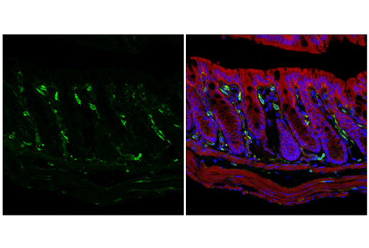 Immunofluorescence Image 2: ApoE (E7X2A) Rabbit Monoclonal Antibody