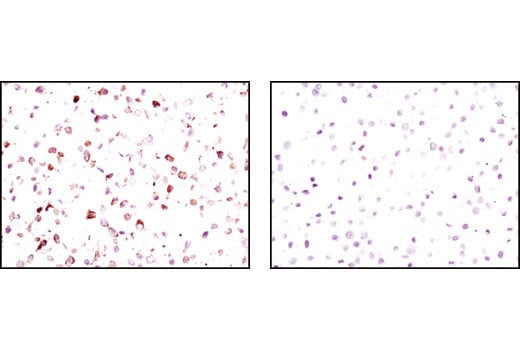 Immunohistochemistry Image 3: Phospho-Met (Tyr1234/1235) (D26) Rabbit Monoclonal Antibody (BSA and Azide Free)