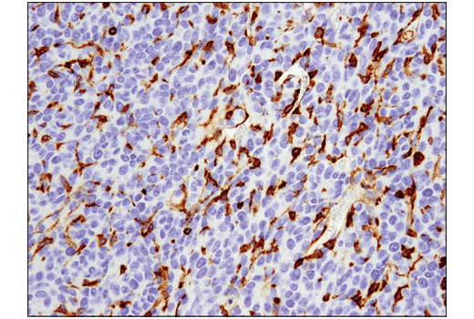 Immunohistochemistry Image 1: VISTA (D5L5T) Rabbit Monoclonal Antibody (BSA and Azide Free)