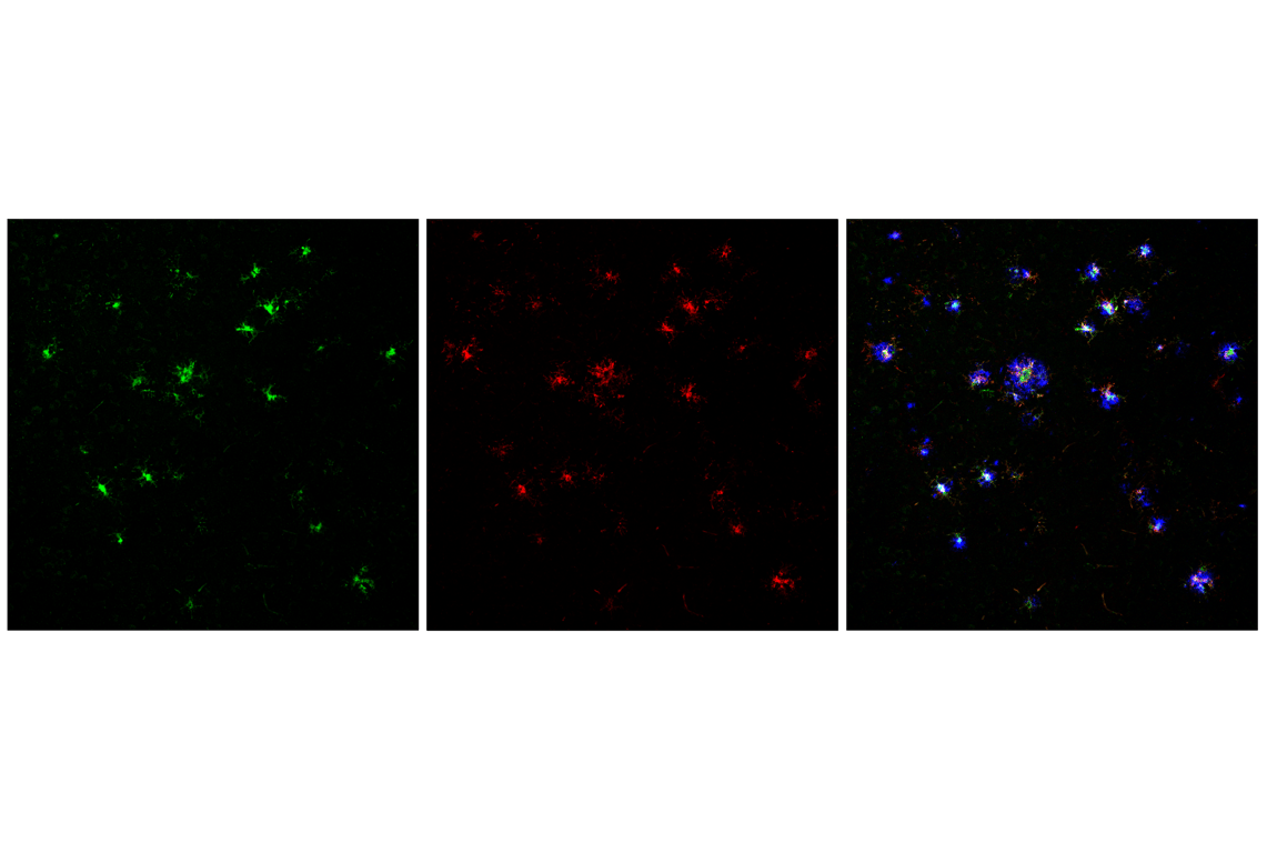 Immunofluorescence Image 1: Dectin-1/ Clec7a (E3P5W) Rabbit Monoclonal Antibody (BSA and Azide Free)