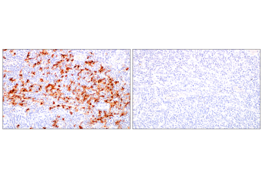 Immunohistochemistry Image 11: LAMP3/CD208 (E6E5U) Rabbit Monoclonal Antibody