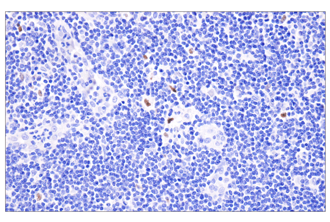 Immunohistochemistry Image 7: INSM1 (BLR272L) Rabbit Monoclonal Antibody