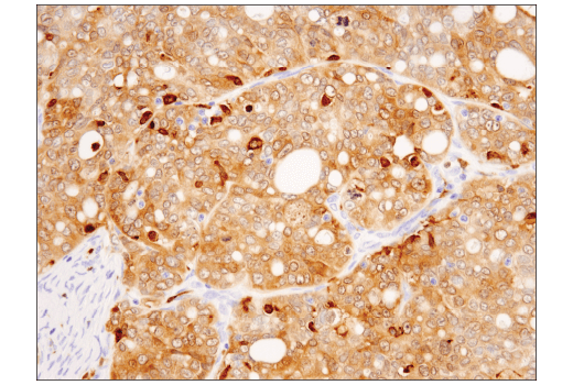 Immunohistochemistry Image 4: Syk (4D10) Mouse Monoclonal Antibody