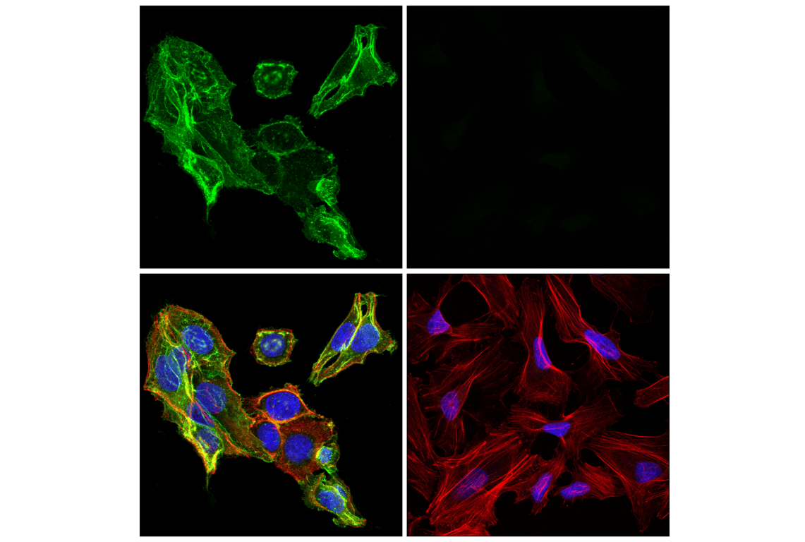 Immunofluorescence Image 1: p75NTR (F2L9S) Rabbit Monoclonal Antibody
