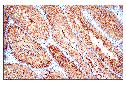 Immunohistochemistry Image 1: Ly6k (E4K8Y) Rabbit Monoclonal Antibody