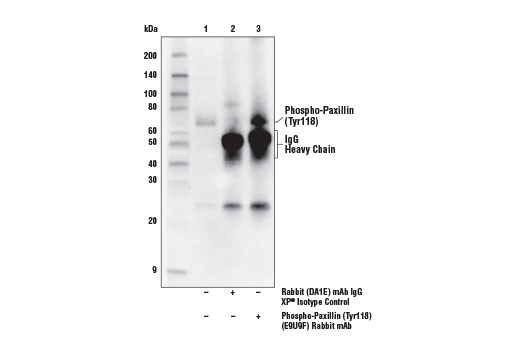 Immunoprecipitation Image 1: Phospho-Paxillin (Tyr118) (E9U9F) Rabbit Monoclonal Antibody