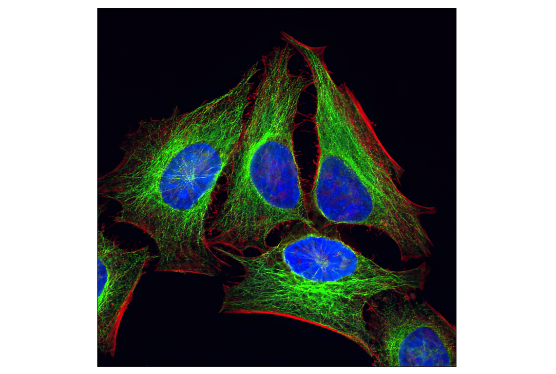Immunofluorescence Image 1: alpha-Tubulin (11H10) Rabbit Monoclonal Antibody