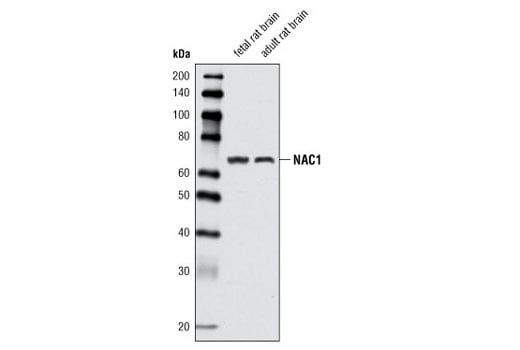 Western Blotting Image 2: NAC1 Antibody
