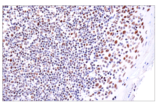 Immunohistochemistry Image 3: PBRM1/BAF180 (D4L9X) Rabbit Monoclonal Antibody
