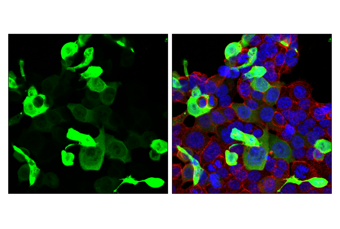 Immunofluorescence Image 1: Firefly Luciferase (E9W9V) Rabbit Monoclonal Antibody
