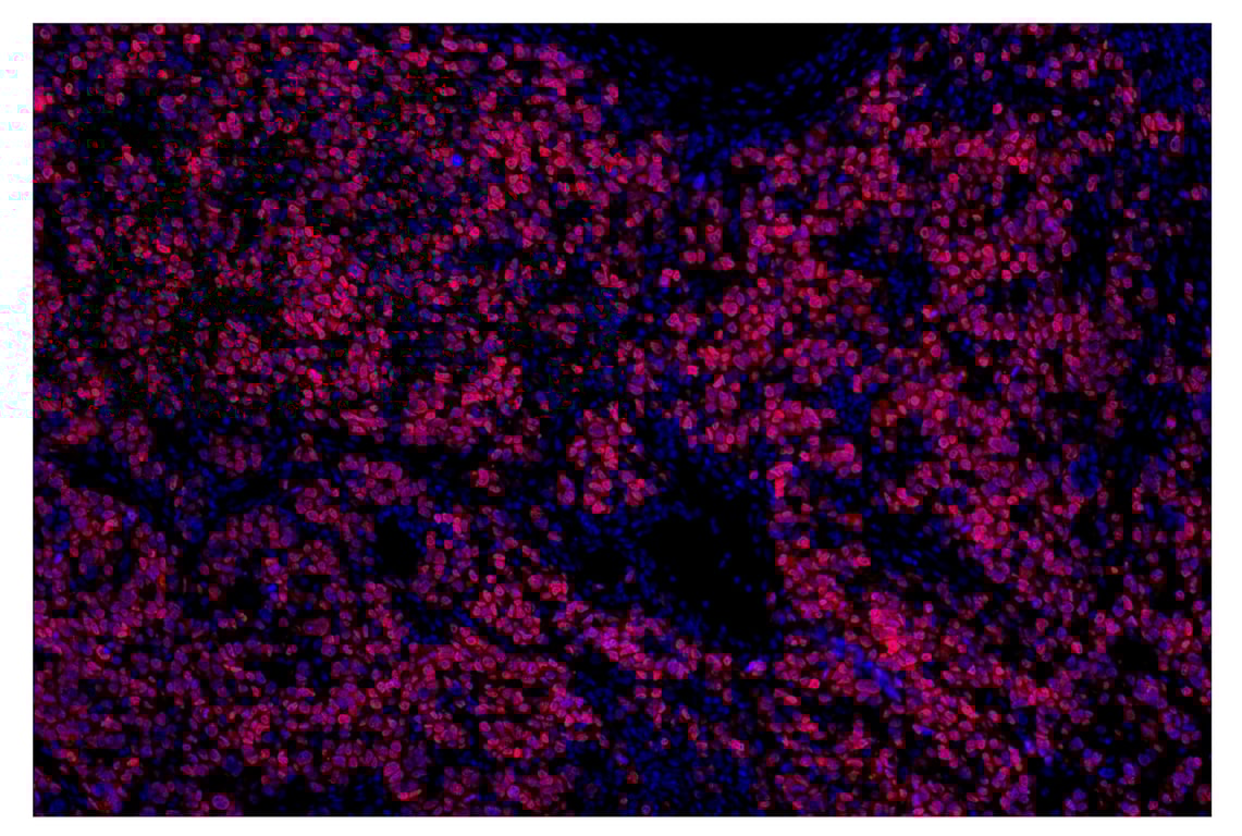 Immunohistochemistry Image 4: Olig2 (E6G6Q) & CO-0124-594 SignalStar<sup>™</sup> Oligo-Antibody Pair