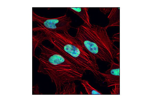 undefined Image 18: Double Strand Breaks (DSB) Repair Antibody Sampler Kit