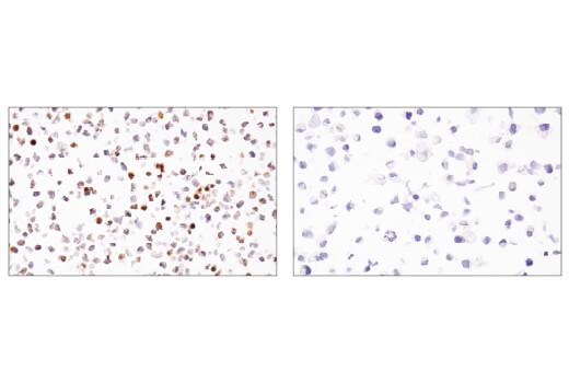 Immunohistochemistry Image 3: BCL6 (E5I8I) Rabbit Monoclonal Antibody