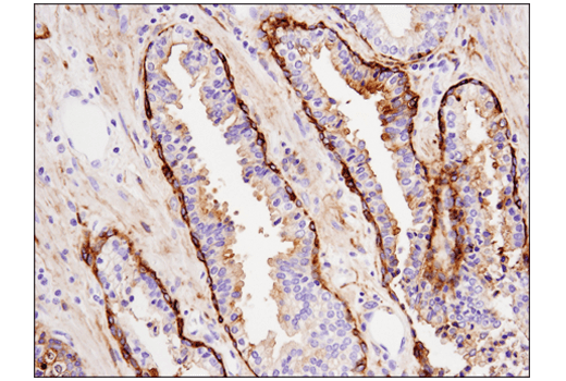 Immunohistochemistry Image 5: Tissue Factor/CD142 (E9M6T) Rabbit Monoclonal Antibody (BSA and Azide Free)