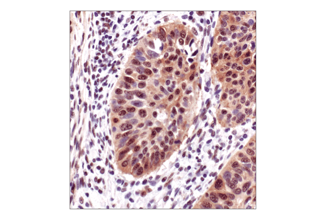 Immunohistochemistry Image 1: Phospho-Akt Substrate (RXXS*/T*) (110B7E) Rabbit Monoclonal Antibody
