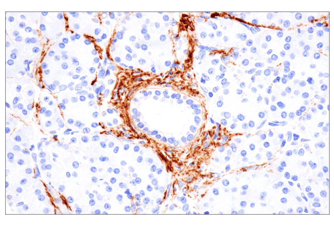 Immunohistochemistry Image 8: Vitronectin (F8D3L) Rabbit Monoclonal Antibody