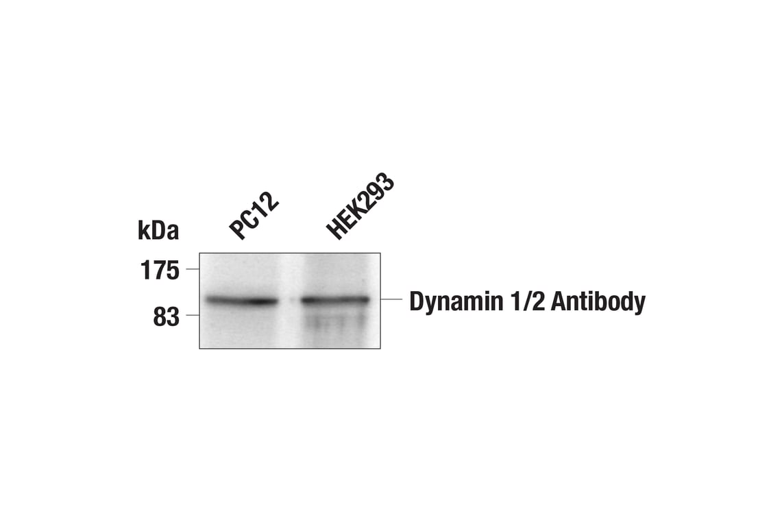Immunoprecipitation Image 1: Dynamin 1/2 Antibody