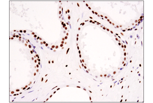 Immunohistochemistry Image 5: Tri-Methyl-Histone H3 (Lys36) (D5A7) Rabbit Monoclonal Antibody (BSA and Azide Free)