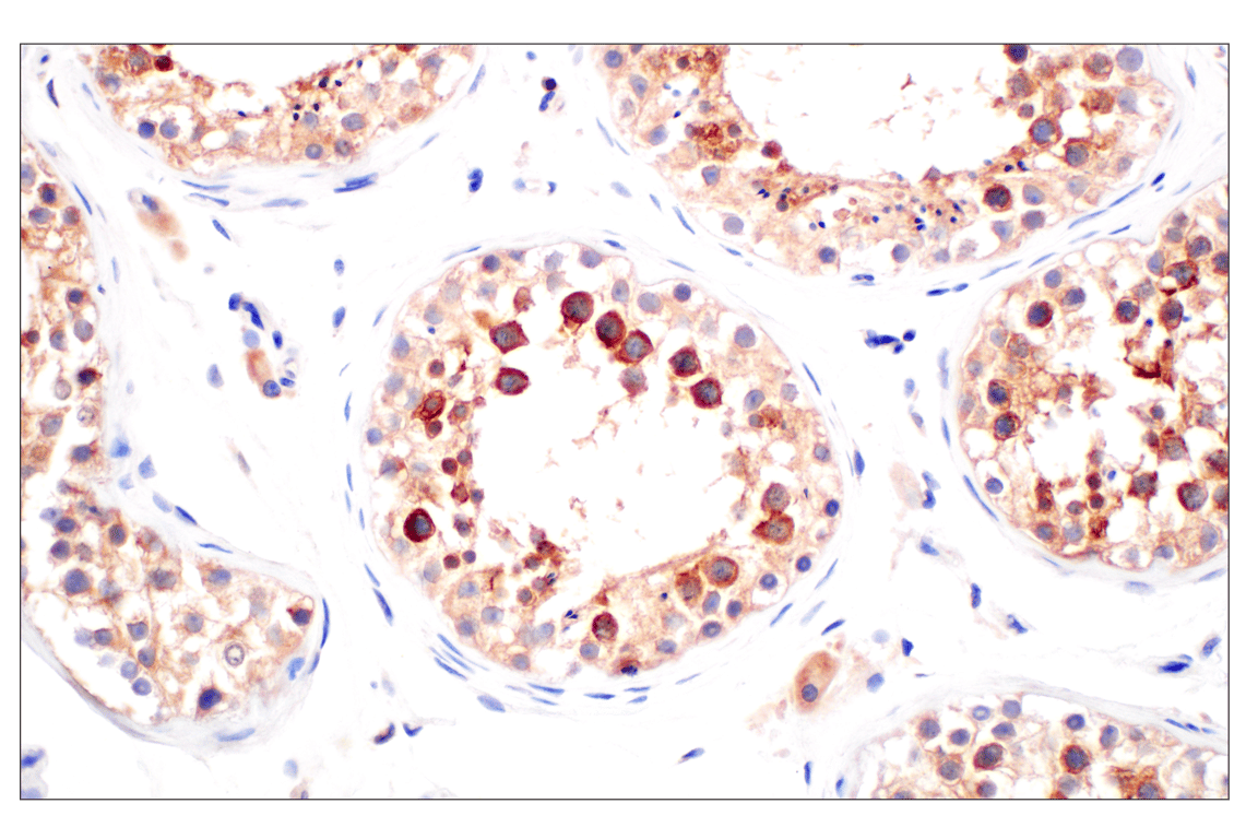 Immunohistochemistry Image 4: WNK1 (F1O3U) Rabbit Monoclonal Antibody