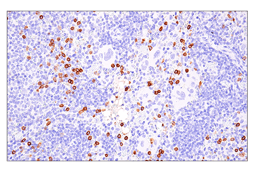 Immunohistochemistry Image 4: NK1.1/CD161 (E6Y9G) Rabbit Monoclonal Antibody