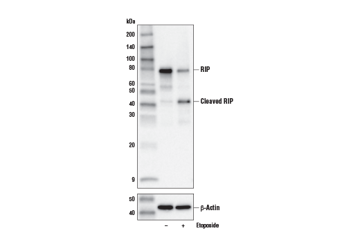 undefined Image 16: Apoptosis/Necroptosis Antibody Sampler Kit II