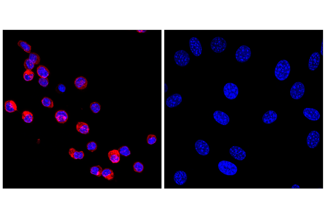 CD31 (PECAM-1) (F2N3M) Rabbit Monoclonal Antibody (Alexa Fluor