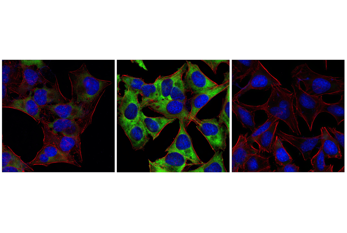 Immunofluorescence Image 1: Phospho-S6 Ribosomal Protein (Ser235/236) (2F9) Rabbit Monoclonal Antibody