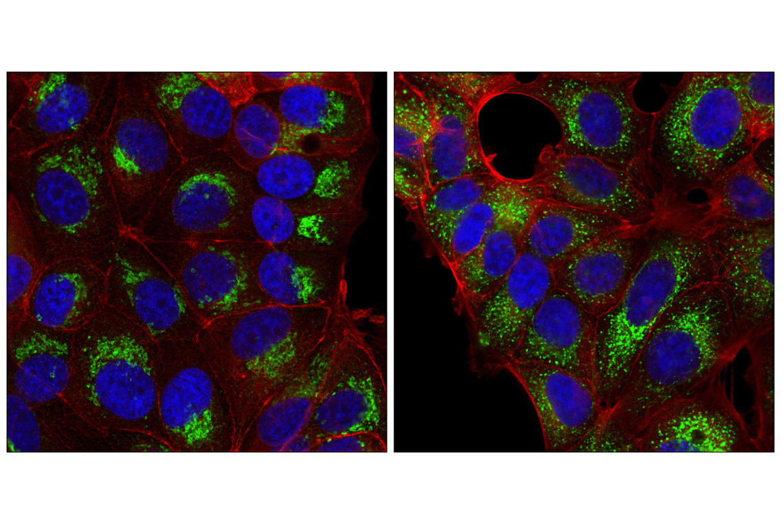 Immunofluorescence Image 1: RCAS1 (D2B6N) Rabbit Monoclonal Antibody (BSA and Azide Free)