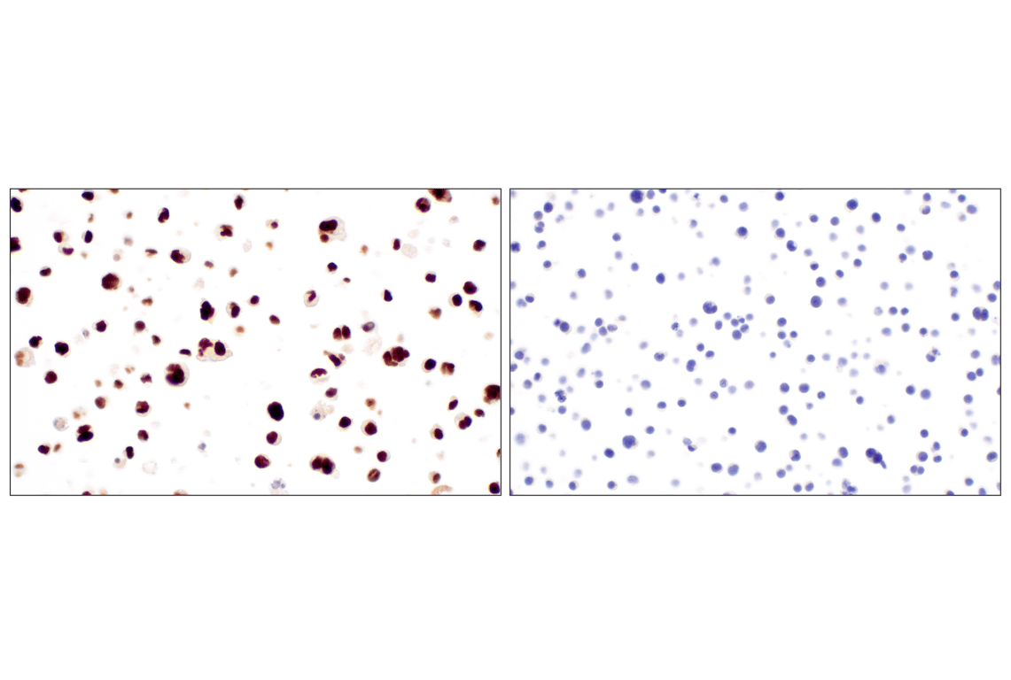 Immunohistochemistry Image 10: MNDA (3C1) Rat Monoclonal Antibody