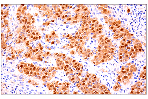 Immunohistochemistry Image 6: Calretinin (E7R6O) Rabbit Monoclonal Antibody (BSA and Azide Free)