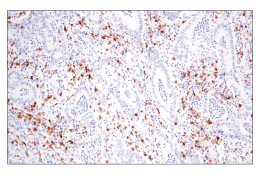 Immunohistochemistry Image 2: GITR (D5V7P) Rabbit Monoclonal Antibody
