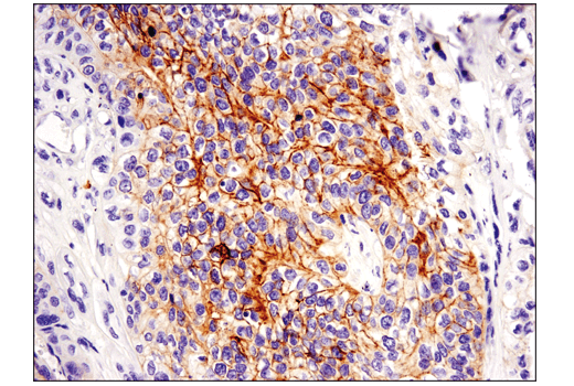 Immunohistochemistry Image 1: c-Kit (D3W6Y) Rabbit Monoclonal Antibody (BSA and Azide Free)