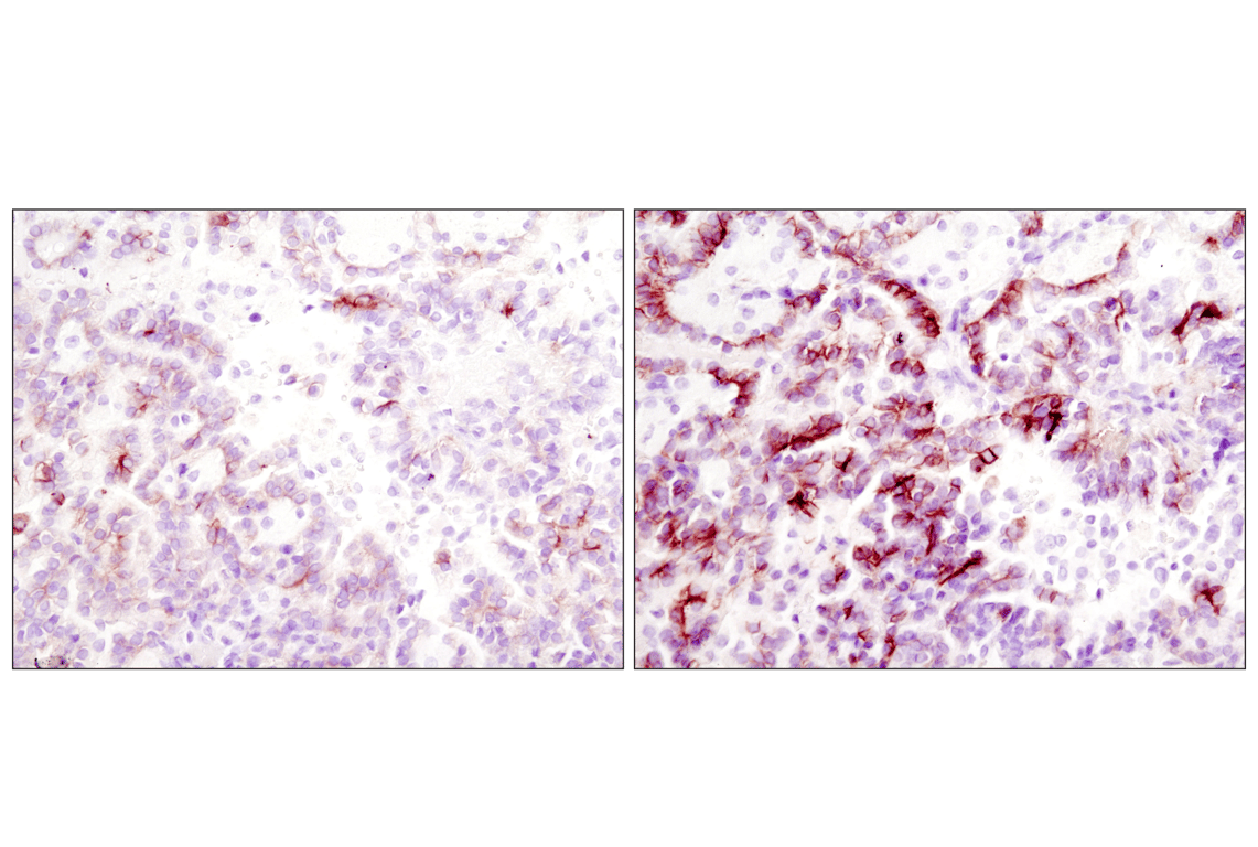 Immunohistochemistry Image 2: SignalStain<sup>®</sup> Boost IHC Detection Reagent (HRP, Rabbit)