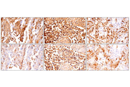 Immunohistochemistry Image 13: alpha-2-Macroglobulin (E6N7X) Rabbit Monoclonal Antibody