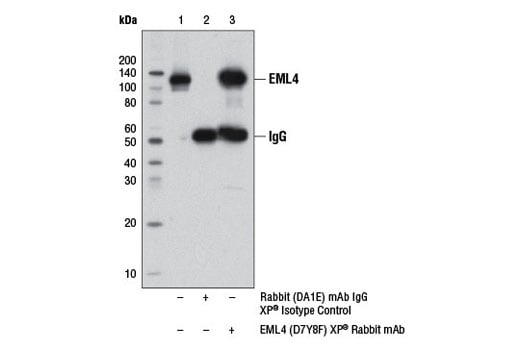 Immunoprecipitation Image 1: EML4 (D7Y8F) Rabbit Monoclonal Antibody