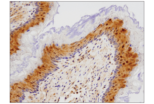 Immunohistochemistry Image 2: SQSTM1/p62 (D6M5X) Rabbit Monoclonal Antibody