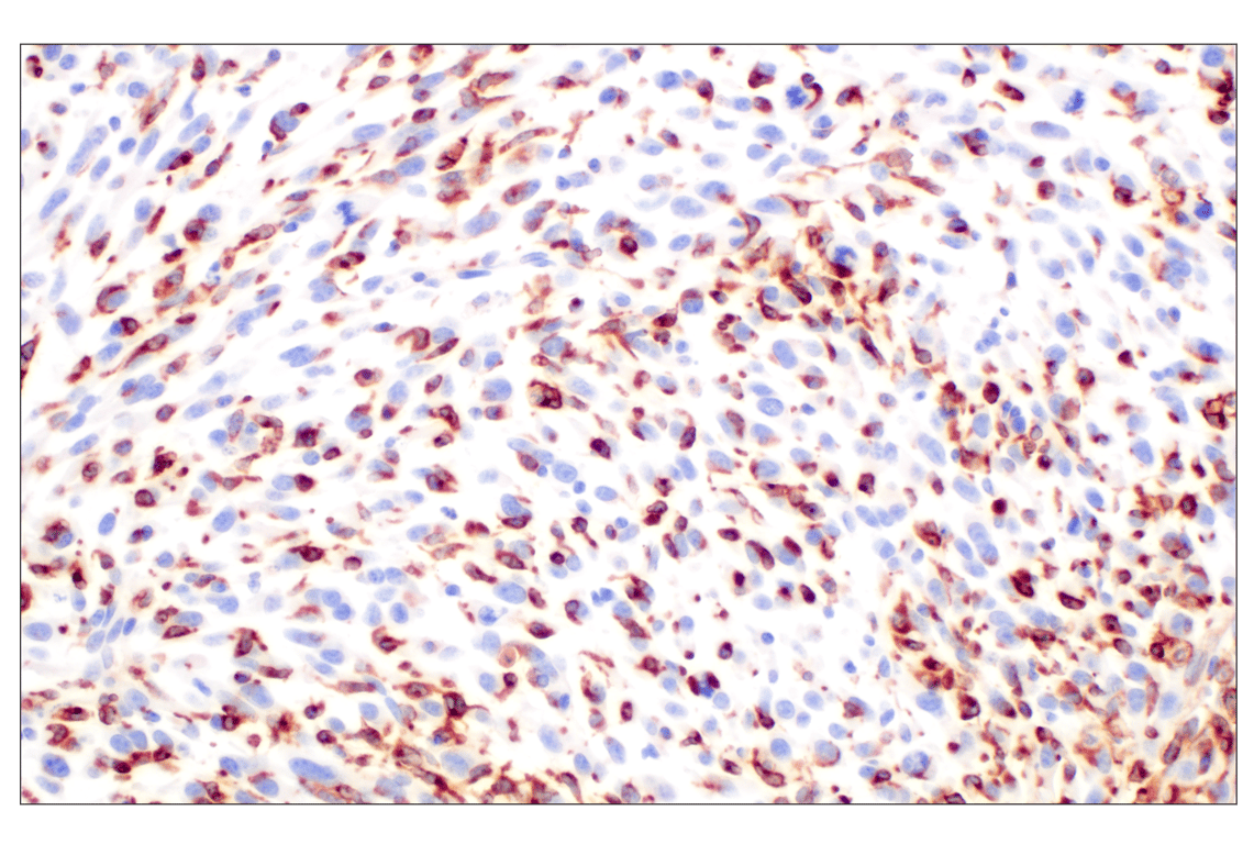 Immunohistochemistry Image 4: CD74 (F3R3L) Rabbit Monoclonal Antibody