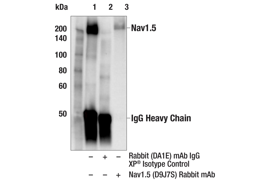 Immunoprecipitation Image 1: Nav1.5 (D9J7S) Rabbit Monoclonal Antibody