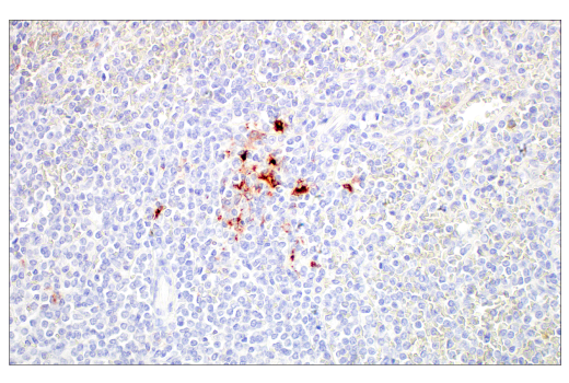 Immunohistochemistry Image 4: LAMP3/CD208 (E6E5U) Rabbit Monoclonal Antibody