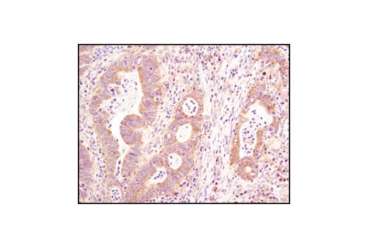 Immunohistochemistry Image 1: Asymmetric-Methyl-PABP1 (Arg455/Arg460) (C60A10) Rabbit Monoclonal Antibody
