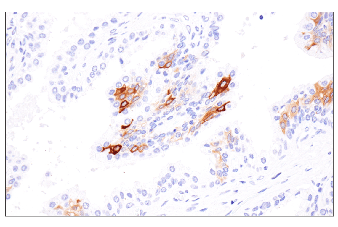 Immunohistochemistry Image 4: Involucrin (F9C3C) Rabbit Monoclonal Antibody