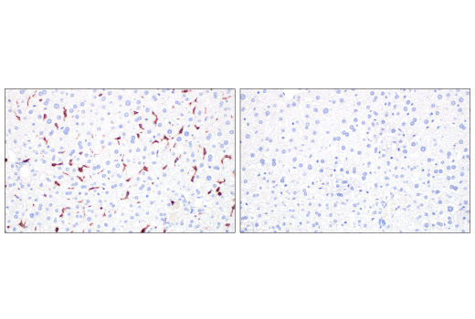 Immunohistochemistry Image 9: Integrin beta2 (E9O7W) Rabbit Monoclonal Antibody