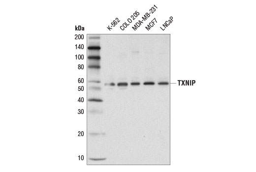 Western Blotting Image 1: TXNIP (D5F3E) Rabbit mAb