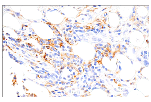 Immunohistochemistry Image 1: GM-CSF Receptor alpha (E8Z3S) Rabbit Monoclonal Antibody