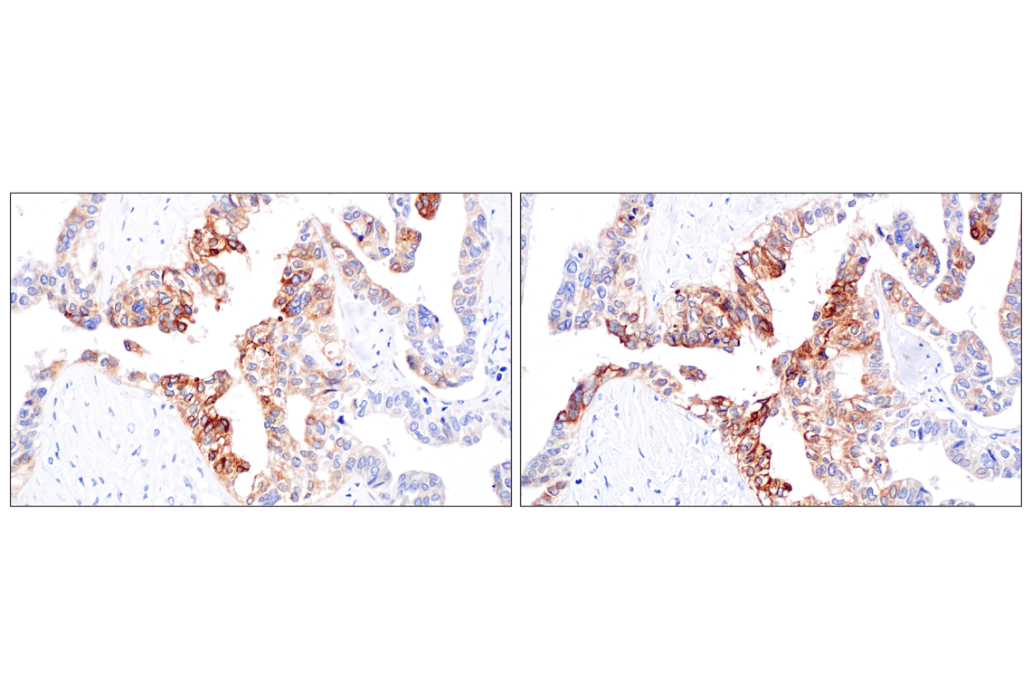 Immunohistochemistry Image 8: IGFBP2 (F3E6V) Rabbit Monoclonal Antibody
