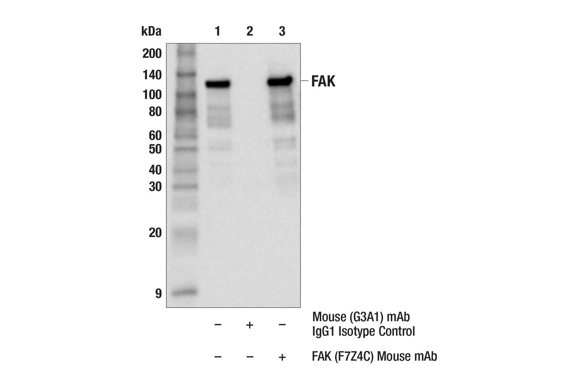 Immunoprecipitation Image 1: FAK (F7Z4C) Mouse Monoclonal Antibody